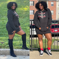 Classic Logo Hooded Dress